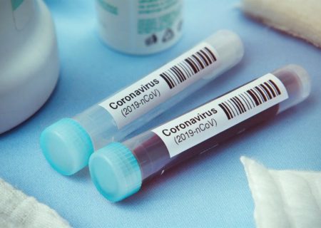 به هیچ عنوان پایان کرونا از راه نرسیده است