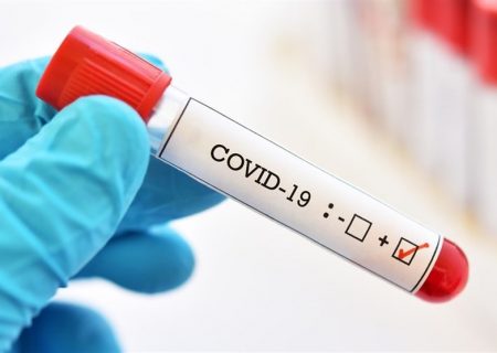 به دلیل پیچیدگی ماهیت ویروس، ساخت واکسن کرونا به آسانی میسر نیست