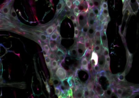 کشف حقایقی جالب درباره دومین مغز بدن