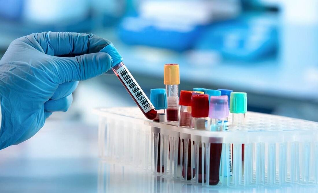 آنچه باید درباره سرطان خون بدانید