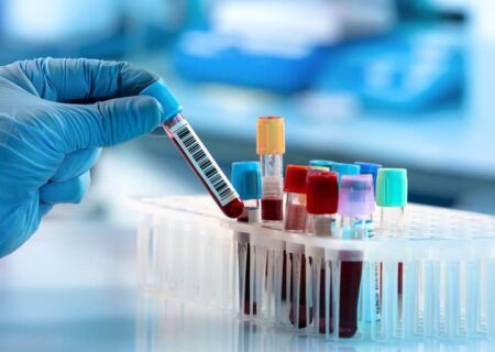 آنچه باید درباره سرطان خون بدانید