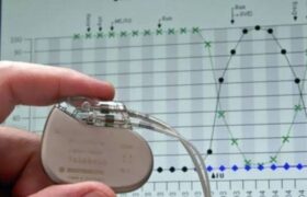 انجام موفقیتآمیز تعبیه نخستین باتری قلبی در کردستان