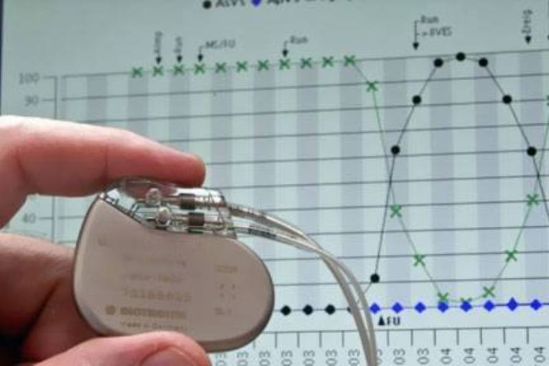 انجام موفقیتآمیز تعبیه نخستین باتری قلبی در کردستان