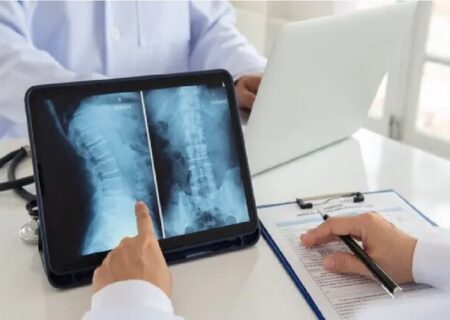 امید به درمان آسیب نخاعی را در سراسر جهان زنده شد