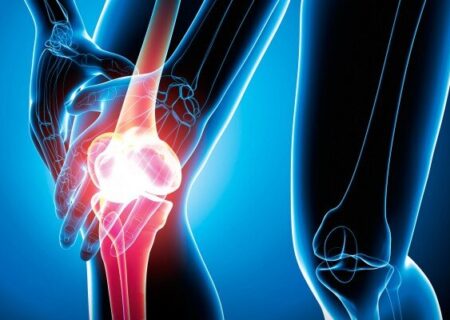 چه کنیم تا زانو درد نگیریم؟