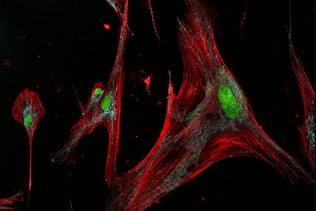 آشنایی با دو روی سکه سلول‌های زامبی