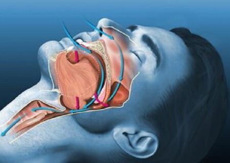 تأثیر تغییرات اقلیمی بر اختلالات خواب