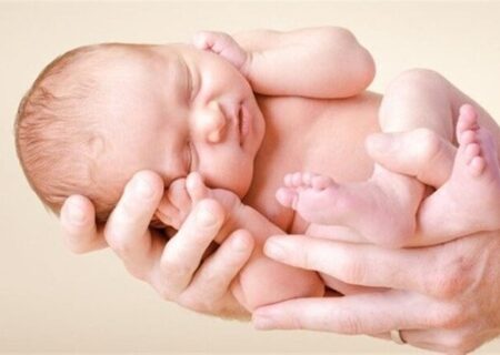 آغوز باعث زردی نوزاد نمی شود