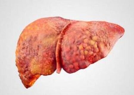 خطر پنهان برای مادران باردار