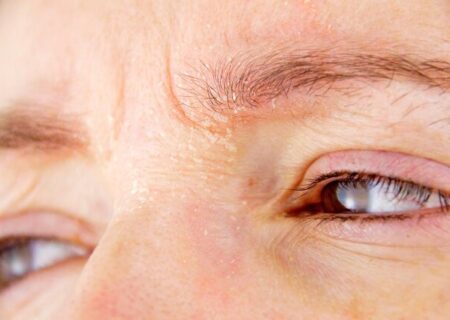 چند راهکار برای تقویت و رشد مجدد ابروها