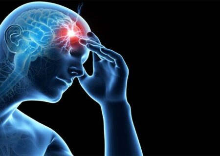 سکته‌های مغزی مکرر می‌توانند به زوال عقل عروقی منجر شوند