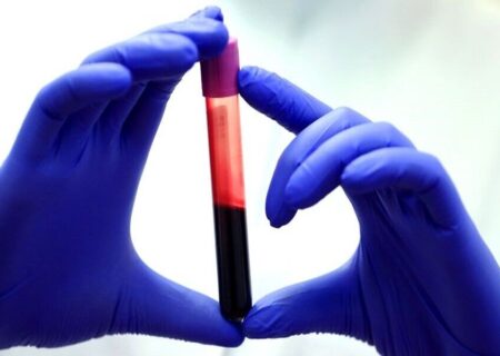 راز صدساله شدن فاش شد