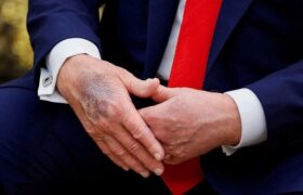 ترامپ استفاده از آسپرین را دلیل کبودی دست خود معرفی کرد