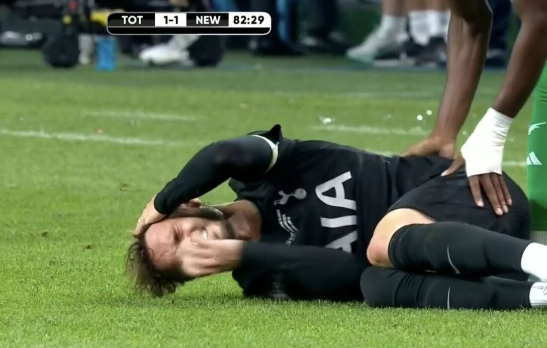 زانوی مدیسون باز هم یاری نکرد