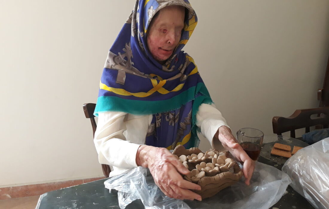 صدور حکم سارق اسیدپاش در استان مرکزی