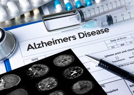 عامل مخفی ابتلا به آلزایمر نمایان شد