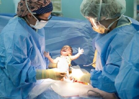 پژوهشی تازه درباره عوارض جدی سزارین در شرایط خاص