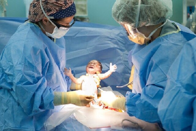 پژوهشی تازه درباره عوارض جدی سزارین در شرایط خاص