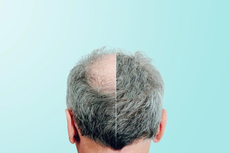 درمان طاسی سر با یک شیرینکننده طبیعی