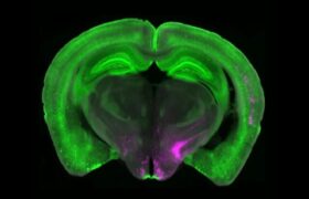 دانشمندان کلید خاموش کردن درد را کشف کردند
