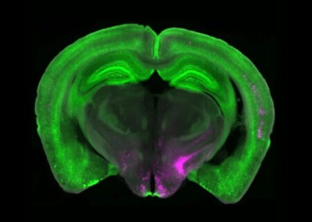دانشمندان کلید خاموش کردن درد را کشف کردند