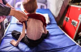 گاردین: سوء تغذیه همچنان در غزه قربانی میگیرد