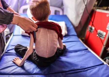 گاردین: سوء تغذیه همچنان در غزه قربانی می‌گیرد