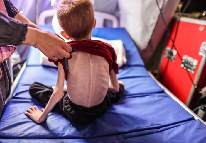 گاردین: سوء تغذیه همچنان در غزه قربانی میگیرد