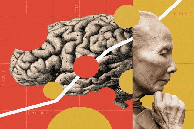 چین در خط مقدم نبرد با آلزایمر