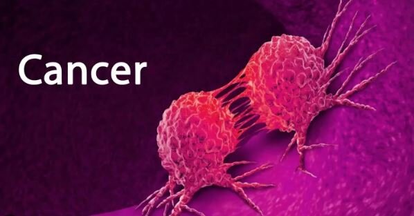 رییس اداره سرطان وزارت بهداشت: ۳۰ تا ۵۰ درصد سرطان‌ها قابل پیشگیری است