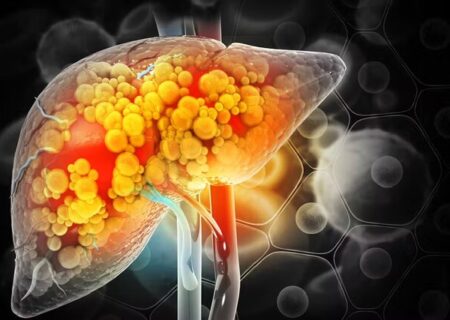 مصرف خودسرانه داروها از عوامل مهم آسیب به کبد