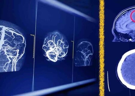 راه‌حل جدید پژوهشگران ایرانی برای افزایش امنیت هوش مصنوعی در تحلیل MRI مغز