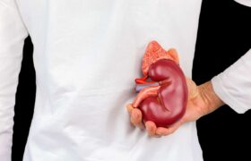 ۴ گروه خوراکی آسیبرسان به کلیهها؛ ضرورت پرهیز از مصرف بیش از حد